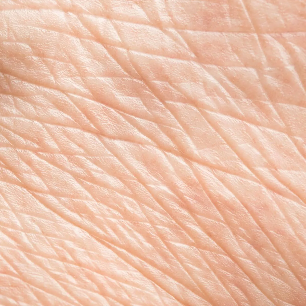 Anelastic skin with wrinkles