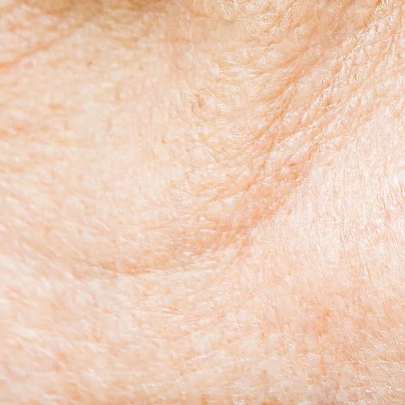 Mature skin with relaxation