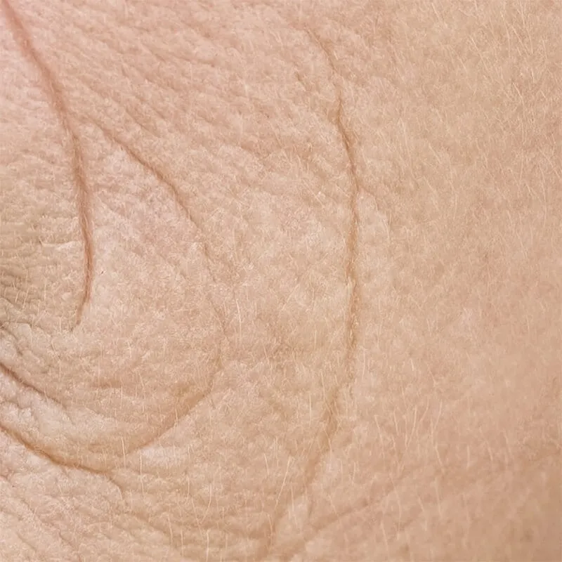 Mature skin with wrinkles