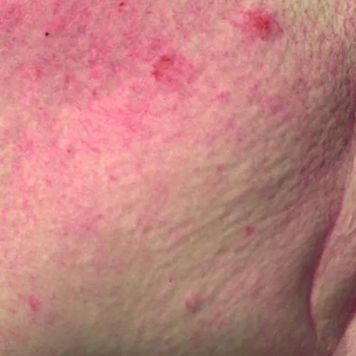 skin
