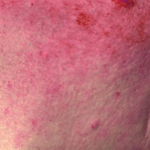 skin
