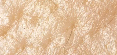 skin